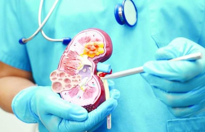 الامارات الان | «دبي الصحية»: 46% نمواً في عمليات زراعة الكلى خلال 2025 | عيون الجزيرة الامارات