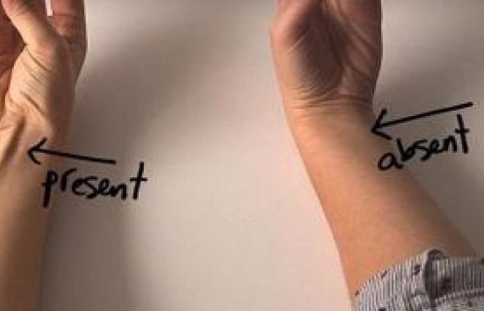 أخبار سلطنة عمان | دراسة بحثية ترصد العلاقة بين العضلة الراحية الطويلة وقوة القبضة | عيون الجزيرة الاخبارية عمان